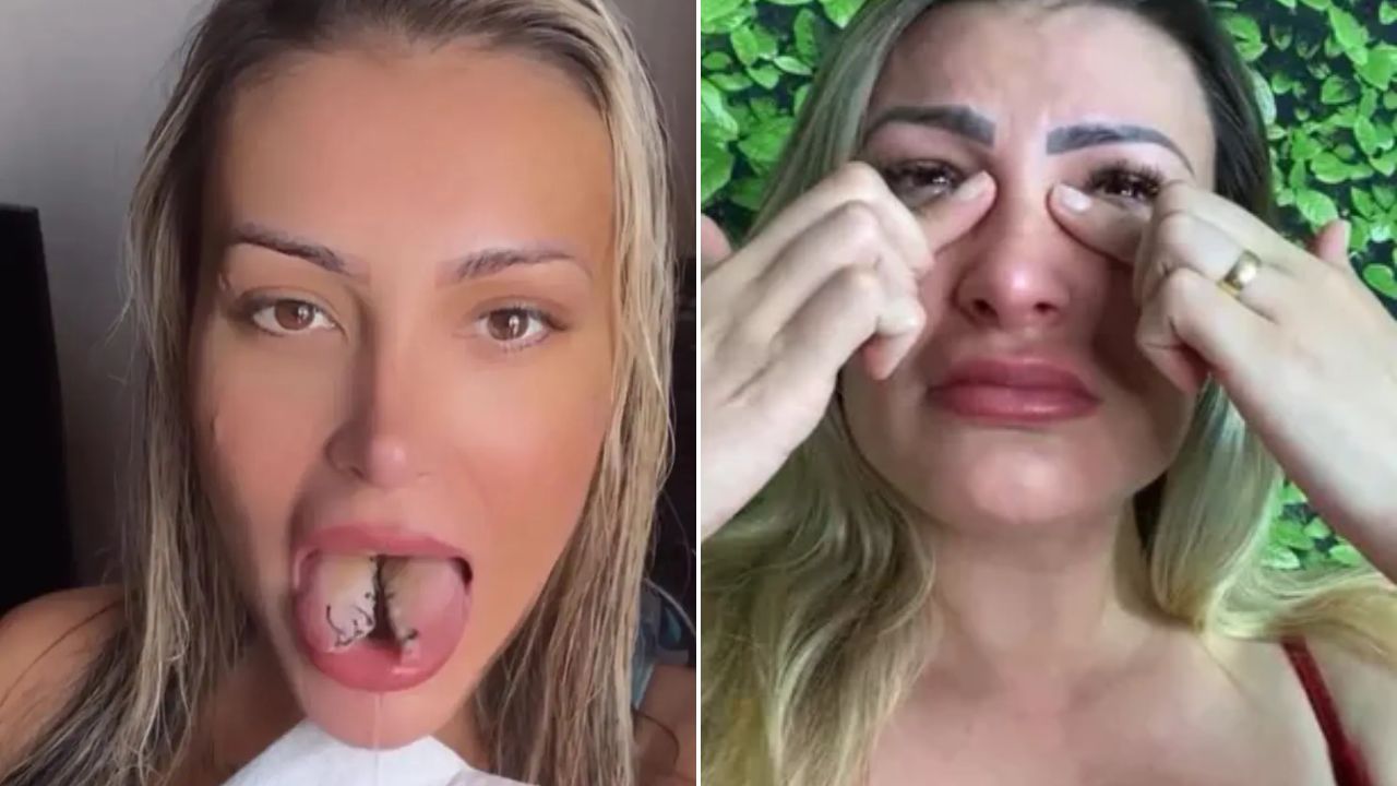 Real Motivo de Andressa Urach Dividir a Língua é Exposto; Modelo Enfrenta Complicação