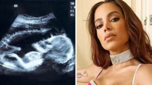 Anitta Grávida? A cantora reage e confessa o que tem em sua barriga