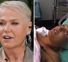 Xuxa Meneghel Choca ao Revelar Doença Irreversível: ‘As Pessoas Ficariam Assustadas’