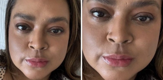 🔥 Preta Gil Recebe Alta, Mas Abre o Jogo Sobre Desafios Inesperados: ‘Vou Ficar Pra Sempre com…’